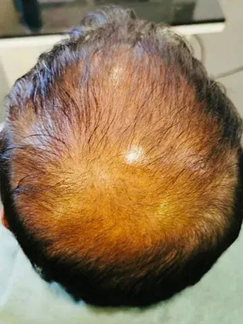 Singapore, Health, Oriental Hair Solutions