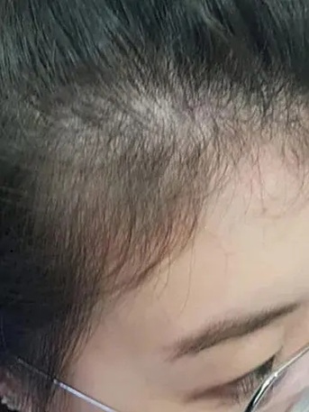 Singapore, Health, Oriental Hair Solutions