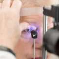 Top Glaucoma Eye Care In Orange County | Prevent Vision Loss &ndash; EyeOC
