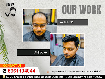 Kolkata, Health & Beauty Items, INR 8000,  Trusted Hair Fixing In Kolkata  &ndash; Indian Hair World
