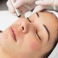 Reveal Smoother, Brighter Skin With Microdermabrasion