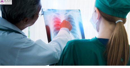 Indore, Health, Medical Thoracoscopy In Indore | Dr. Munira Shapurwala