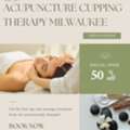 Acupuncture Cupping Therapy Milwaukee
