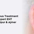 Preauricular Sinus Treatment & Surgery By Expert ENT Specialist In Jaipur & Ajmer