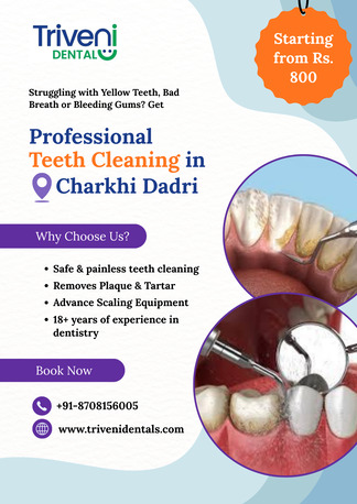 Haryana, Dental, Best Teeth Cleaning (Scaling) In Charkhi Dadri | Triveni Dental