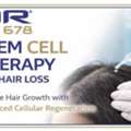 Stem Cell Therapy For Hair Loss At QR678 Clinic India