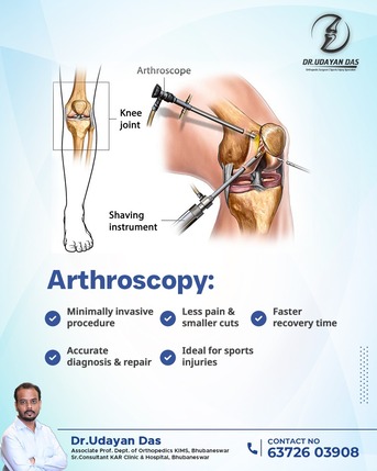 Bhubaneswar, Health, Arthroscopy For Knee Joint Pain | Best Orthopedic Doctor In Bhubaneswar | Dr. Udayan Das.