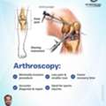 Arthroscopy For Knee Joint Pain | Best Orthopedic Doctor In Bhubaneswar | Dr. Udayan Das.