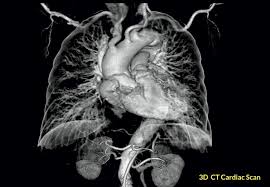 Melbourne, Medical, Cardiac CT Scan Wollert