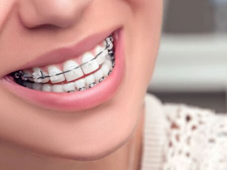 Mumbai, Health, Best Dental Clinic Dombivli | Dr Hosing Orthodontics