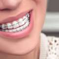 Best Dental Clinic Dombivli | Dr Hosing Orthodontics