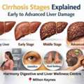 Cirrhosis Stages Explained | Expert Care At Harmony