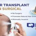 Hair Transplant Non Surgical For Natural Hair Growth