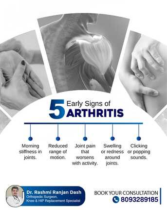 Bhubaneswar, Health, Five Early Signs Of Arthritis | Arthroscopy Surgeon In Bhubaneswar | Dr. Rashmi Ranjan Das