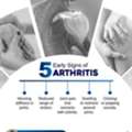 Five Early Signs Of Arthritis | Arthroscopy Surgeon In Bhubaneswar | Dr. Rashmi Ranjan Das