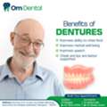 Best Dental Implants In Kokapet-Om Dental