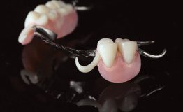 Beijing, Dental, Chrome Cobalt Framework Dentures