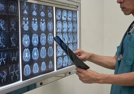 Ahmedabad, Health, Neurosurgeon In Mumbai &ndash; Advanced Brain And Spine Care