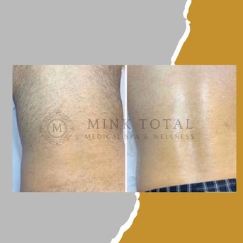 New York, Medical, Mink Total Medical Spa & Wellness