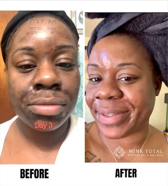 New York, Medical, Mink Total Medical Spa & Wellness