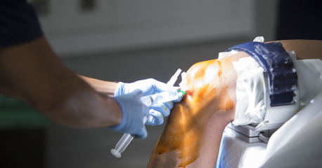 Ahmedabad, Health, Knee Arthroscopy Treatment In Ahmedabad &ndash; Advanced Joint Care