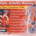 Psoriatic Arthritis Warning Signs: Check These 9 Symptoms Today