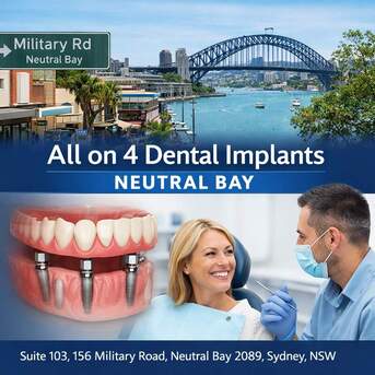 Sydney, Dental, Permanent Tooth Replacement With All On 4 Dental Implants Neutral Bay