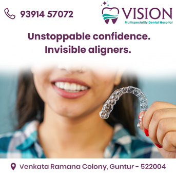 Kurnool, Health & Beauty Items, INR 1,  Invisible Aligners Treatment In Guntur | Advanced Smile Correction At Vision Dental