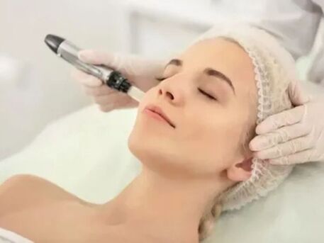 Houston, Health, Microneedling Treatment Near Me | Lean-Ish Houston
