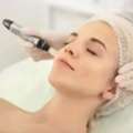 Microneedling Treatment Near Me | Lean-Ish Houston