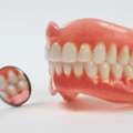 Affordable Artificial Teeth Price In Pakistan &ndash; Quality Dental Solutions At Hash Clinics