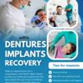 Are Denture Implants Worth It?