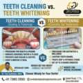 TEETH CLEANING OR WHITENING? FIND OUT WHAT YOU NEED!