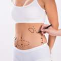 Best Tummy Tuck Surgery In Delhi For A Flat, Firm Abdomen