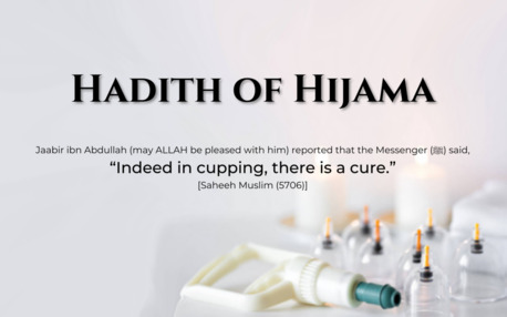 Riyadh, Creative, Hijama (Cupping) In Sunnah Days (Best Time To Do Hijama In Sunnah Dates)