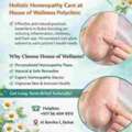 Psoriasis Treatment In Dubai &ndash; Holistic Homeopathy Care At House Of Wellness Polyclinic