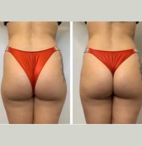 Toronto, Health, Nano Beauty Star