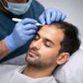 Hair Transplant In Balewadi - The Aesthetic Hub