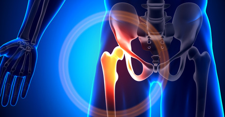 Ahmedabad, Health, Restoring Mobility With Hip Replacement Surgery In Ahmedabad