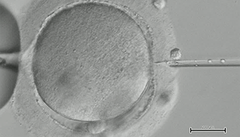 San José, Health, Affordable IVF Colombia Cost: Complete Pricing Guide For 2026