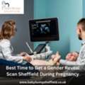 Best Time To Get A Gender Reveal Scan Sheffield During Pregnancy