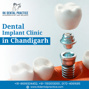 Chandigarh, Dental, Best Dental Implant Clinic In Chandigarh