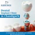 Best Dental Implant Clinic In Chandigarh