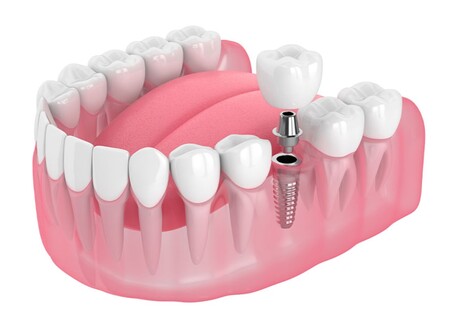 New York, Dental, ORA4X (Elk Grove)