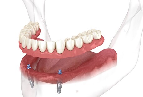 New York, Dental, ORA4X (Elk Grove)