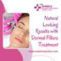 Natural Looking Results With Dermal Fillers Treatment