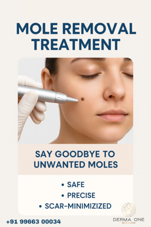 Visakhapatnam, Health, Mole Removal Treatment Derma One Clinic
