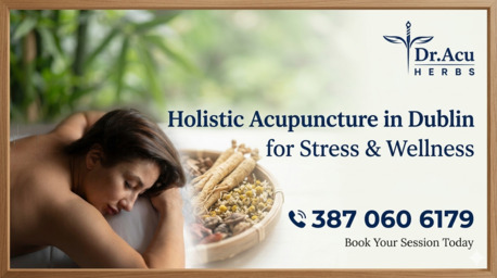 Dublin, Health, Holistic Acupuncture In Dublin For Stress & Wellness