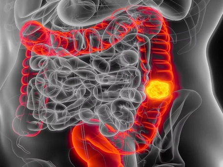 Singapore, Health, Dr Calvin Ong