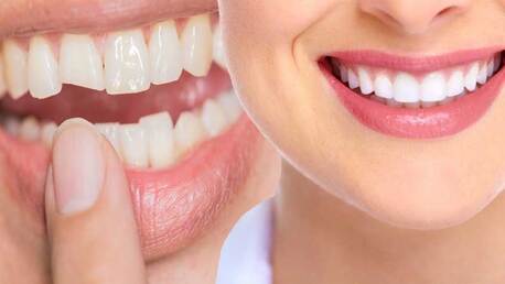 Miami, Health, Miami Cosmetic Dentistry For Professional Teeth Whitening